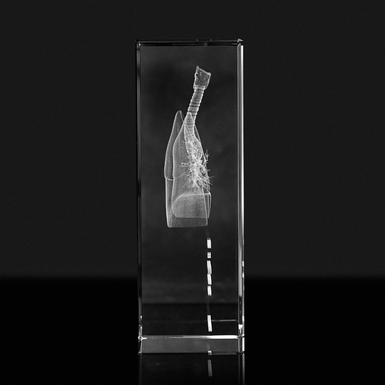 Statuetka Medyczna - Płuca 3D - Podziękowania dla Lekarza, Przychodni